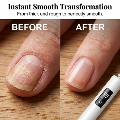 🎁 Limited-Time Special Offer 💥 Professional Electric Nail Grinder — Effortlessly Grind and Shape Thick Nails 🌟💎